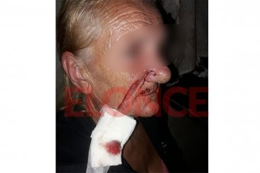 VIDEO: Disparos, agresiones y una mujer herida con un "machete" en Paraná