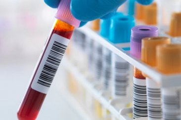 La mujer - de 43 años - había dado positivo para Dengue. La mujer - de 43 años - había dado positivo para Dengue.