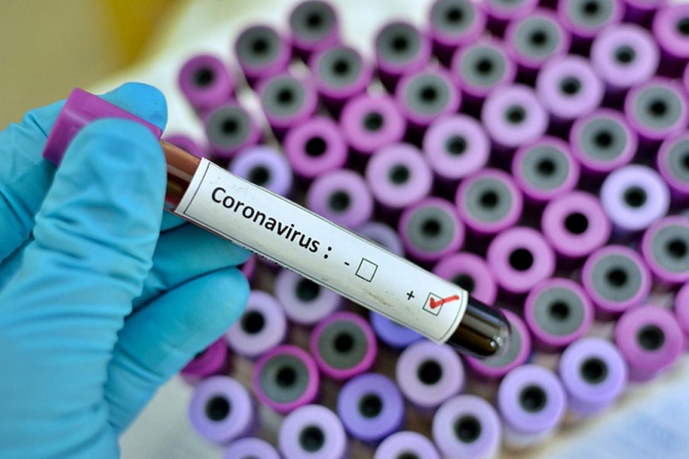El Malbran confirmó nuevos casos de COVID - 19 en Entre Ríos