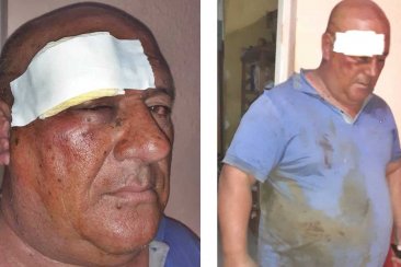 El trabajador fue herido y el gremio adelantó que habrá medidas de fuerza. El trabajador fue herido y el gremio adelantó que habrá medidas de fuerza.