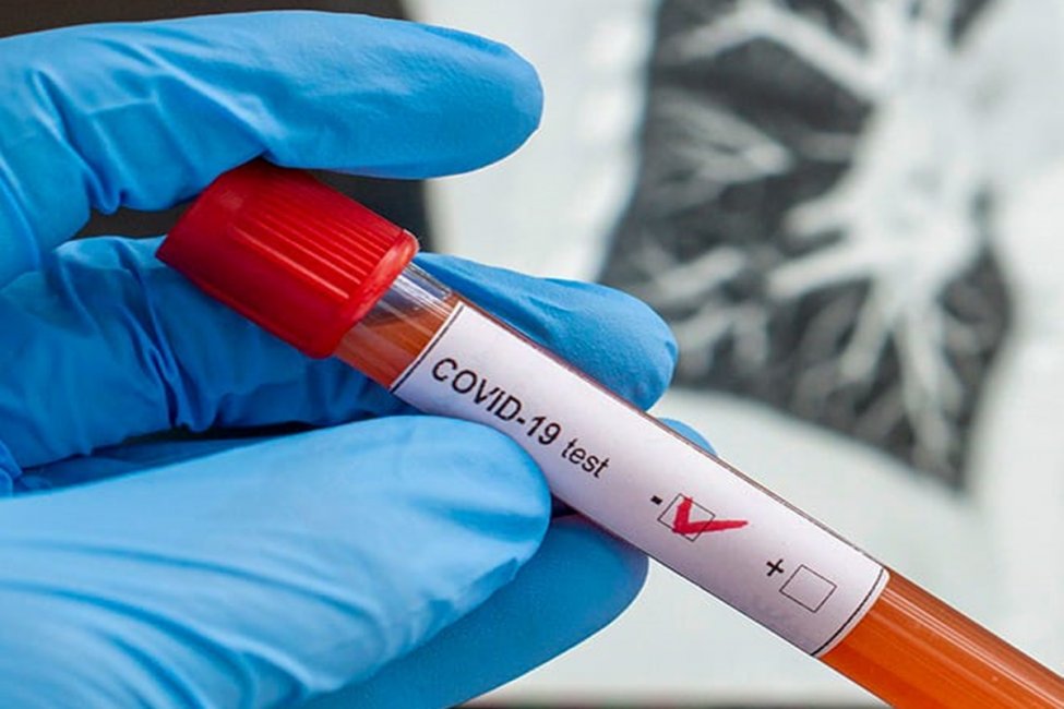 Entre Ríos sumó este miércoles 99 casos de Coronavirus de los cuales 1 pertenece a Concordia