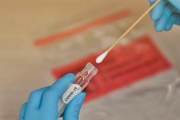 Crece la demanda para hisoparse de forma voluntaria. Crece la demanda para hisoparse de forma voluntaria.