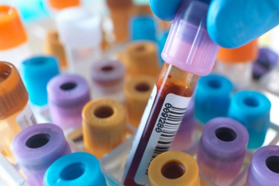 Entre Ríos sumó este jueves 134 casos de Coronavirus