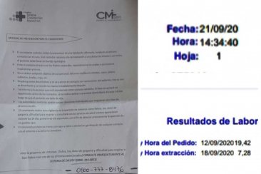 Debió esperar casi 10 días por el resultado de su prueba. Debió esperar casi 10 días por el resultado de su prueba.