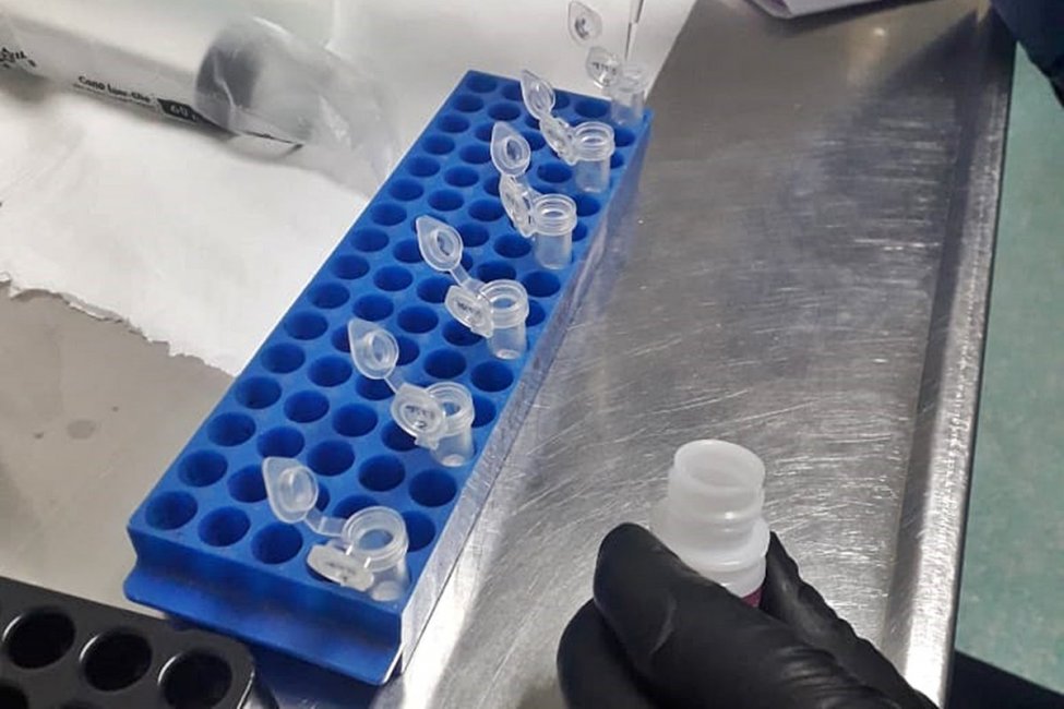 Francolini remarcó la importancia de que el laboratorio del Masvernat ya esté operativo para la detección de COVID 19