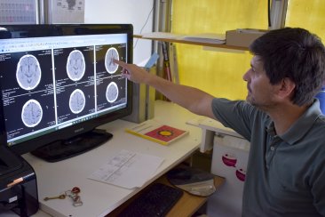 El ACV constituye la primera causa de discapacidad de origen neurológico. El ACV constituye la primera causa de discapacidad de origen neurológico.