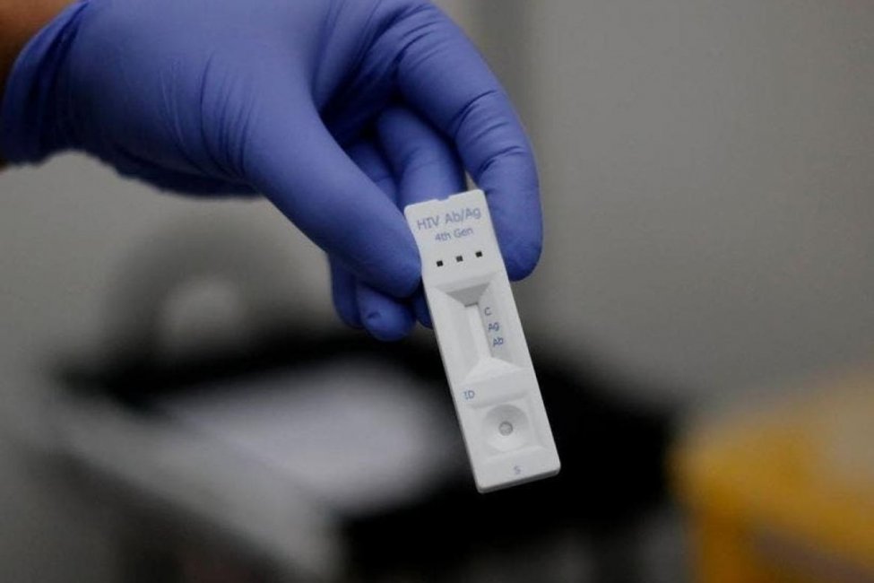 Laboratorios de Concordia comenzarán a realizar testeos de VIH gratuitos una vez al mes