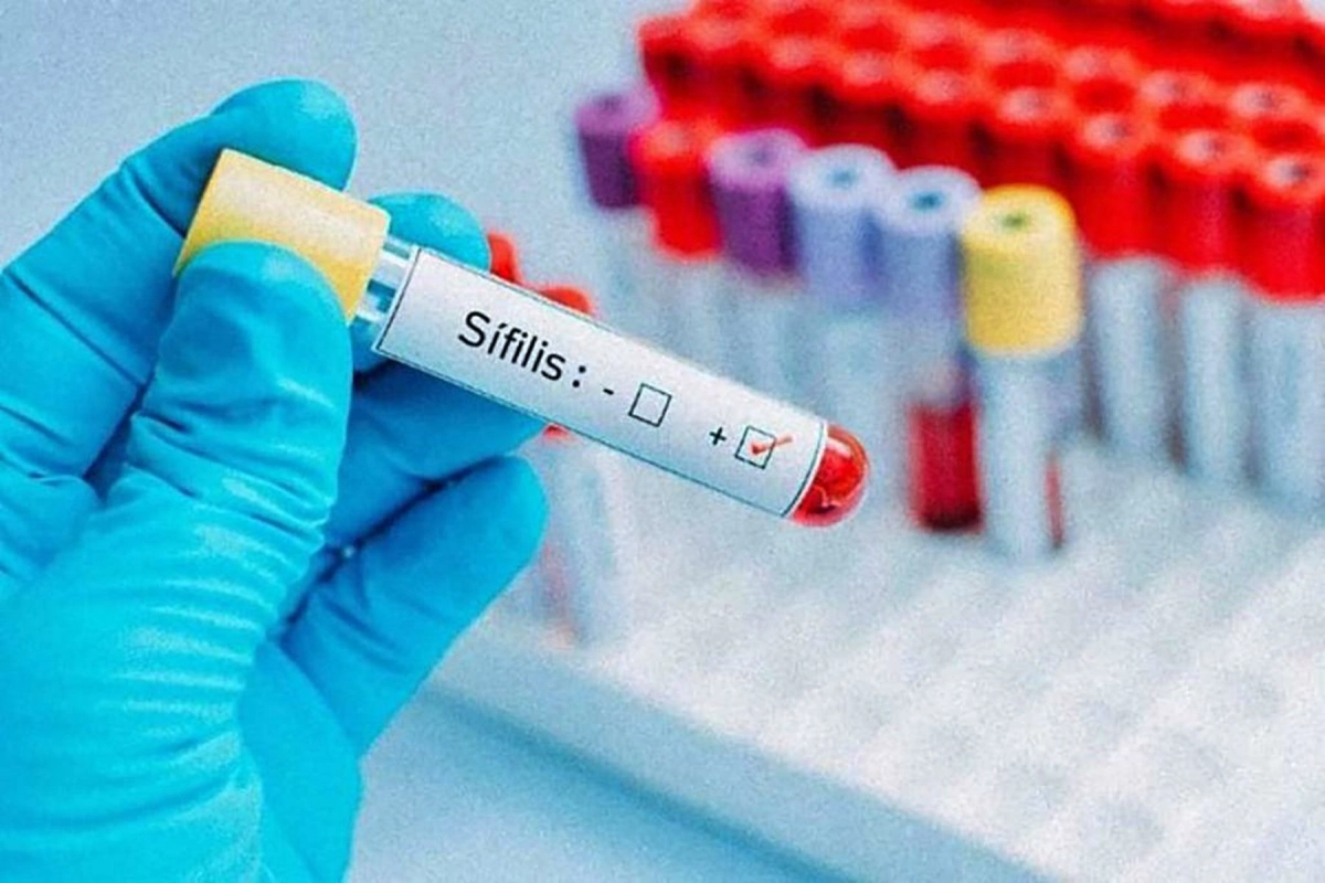 Aumento crítico de los casos.